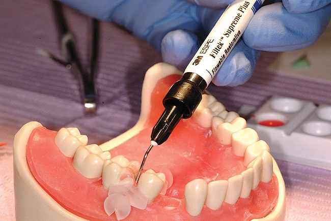 Injection Molding Techniques