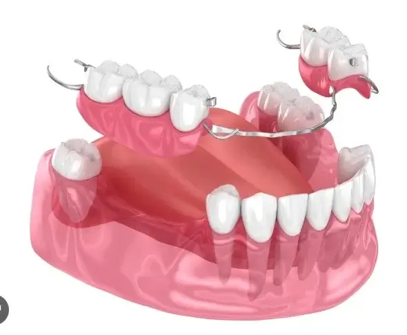 Partial Dentures fills the gaps to restore your smile