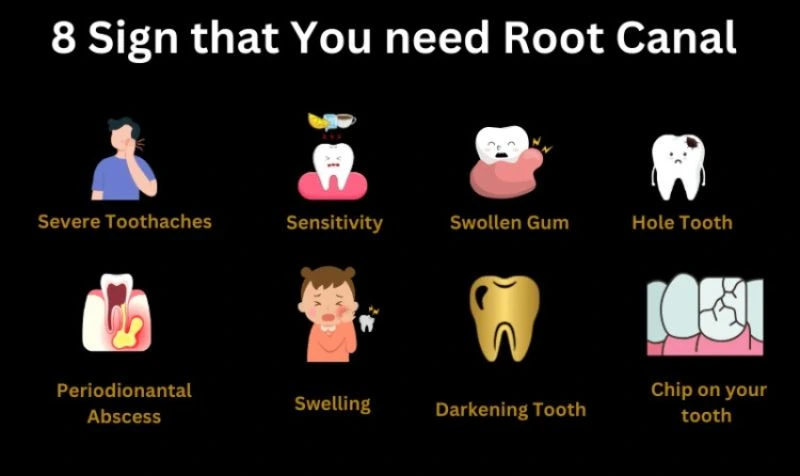 8 Signs you may need a root canal treatment, including common dental symptoms