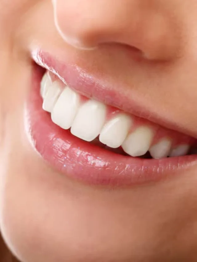 Teeth Whitening Secrets for a Brighter Smile