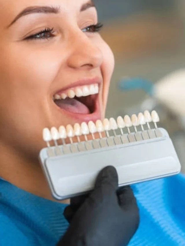 Are Veneers the New Smile Trend in Australia