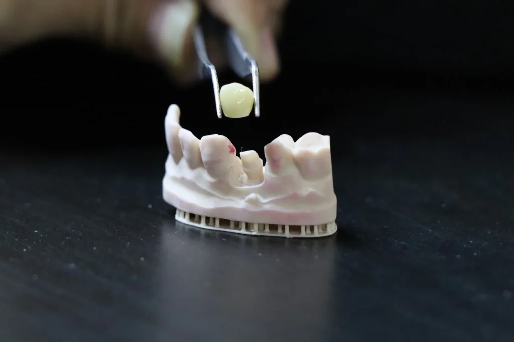 what are dental crowns