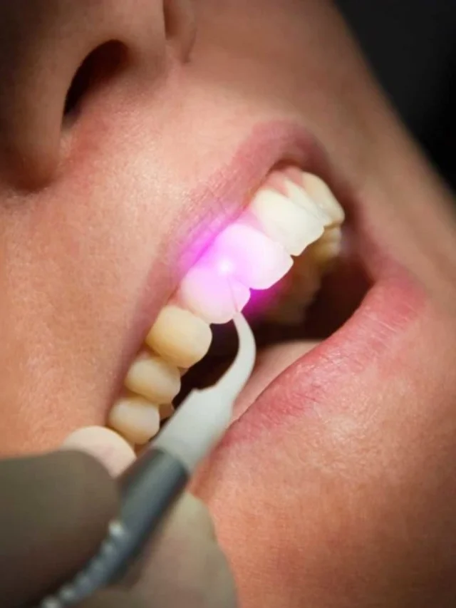 Experience Comfortable Dental Care with Laser Treatment